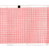 Vermed Recording Chart Paper – Compatible con Equipos de Monitoreo Médico