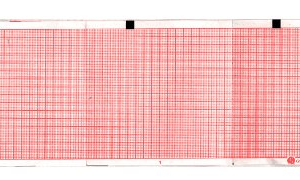 Vermed Recording Chart Paper – Compatible con Equipos de Monitoreo Médico